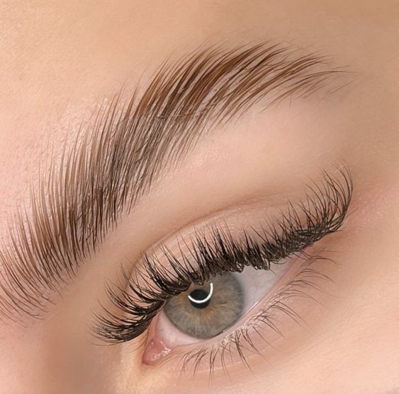 Brow Lift