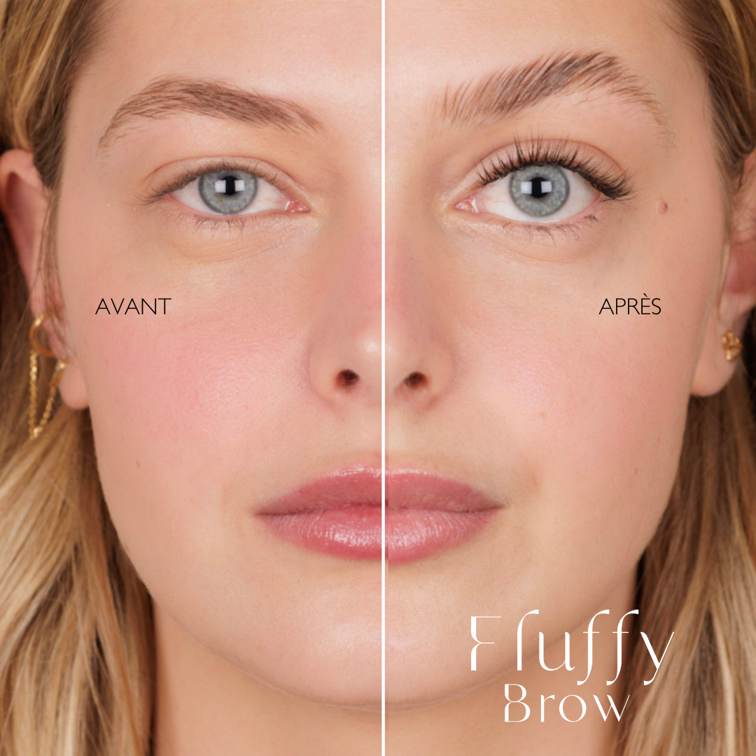 BROW LIFT KIT